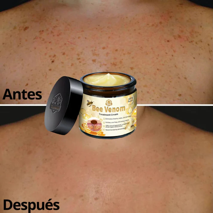 🐝 CREMA DE TRATAMIENTO BEE VENOM BSWELL