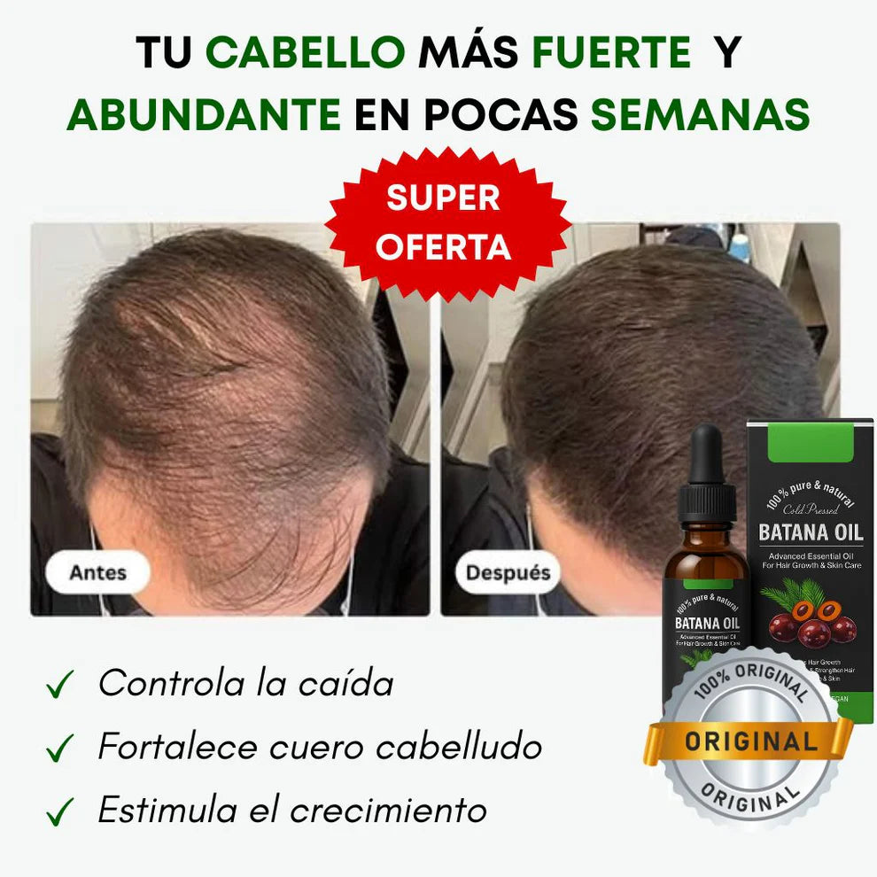 🍃 Aceite Batana : El Secreto Ancestral para Prevenir la Caída del Cabello y Estimular el Crecimiento