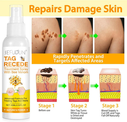 Eliminador de Verrugas Tag Recede® Original - Últimas 7 Unidades 🔥