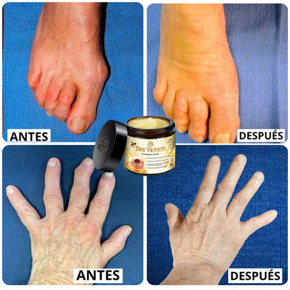 🐝 CREMA DE TRATAMIENTO BEE VENOM BSWELL.
