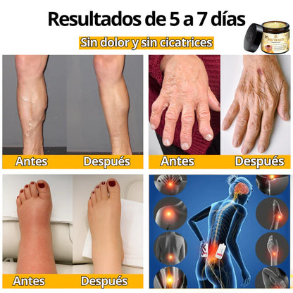 🐝 CREMA DE TRATAMIENTO BEE VENOM BSWELL.